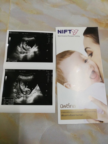 3เดือนแล้วจร้า