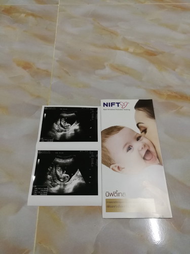 3เดือนแล้วนะ