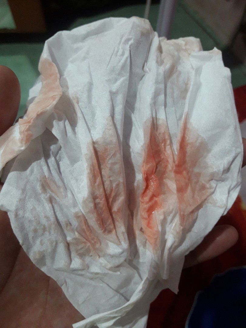 flek d usia 37week2day