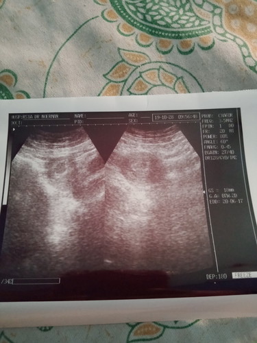 apa kah ini yag di sbut lemah kandungn