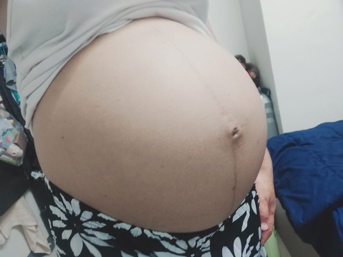 ไหนใครอายุครรภ์ 36+3 Week เท่าเราบ้าง???