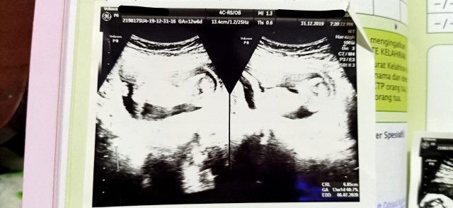 Mom Dev's profile icon