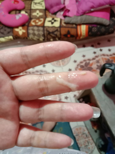 มูกหรือตกขาวคะ 😪🤦