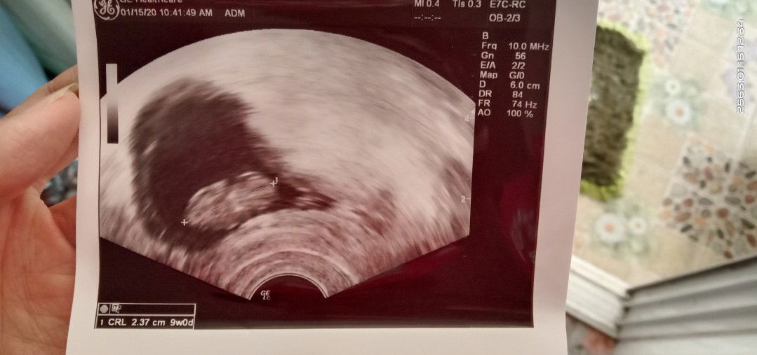 ยาเหน็บนี้หมอเค้าให้มาเหน็บเองหรอค่ะ