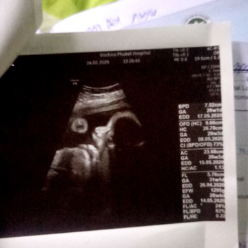 ดูไม่เป็น