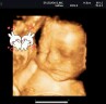 Charinee Pimboot profile icon