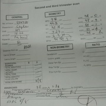 38 weeks day 5  not seen gender . ☹️ still no sign din po.