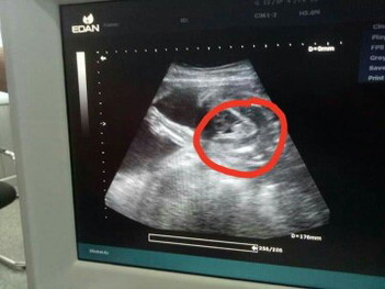 ดูเพศ