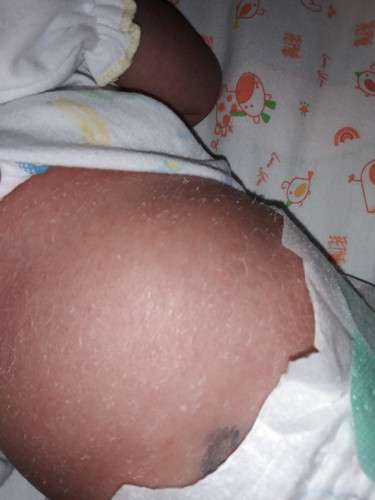 ตัวลอกแบบนี้เป็นรัยมั้ย