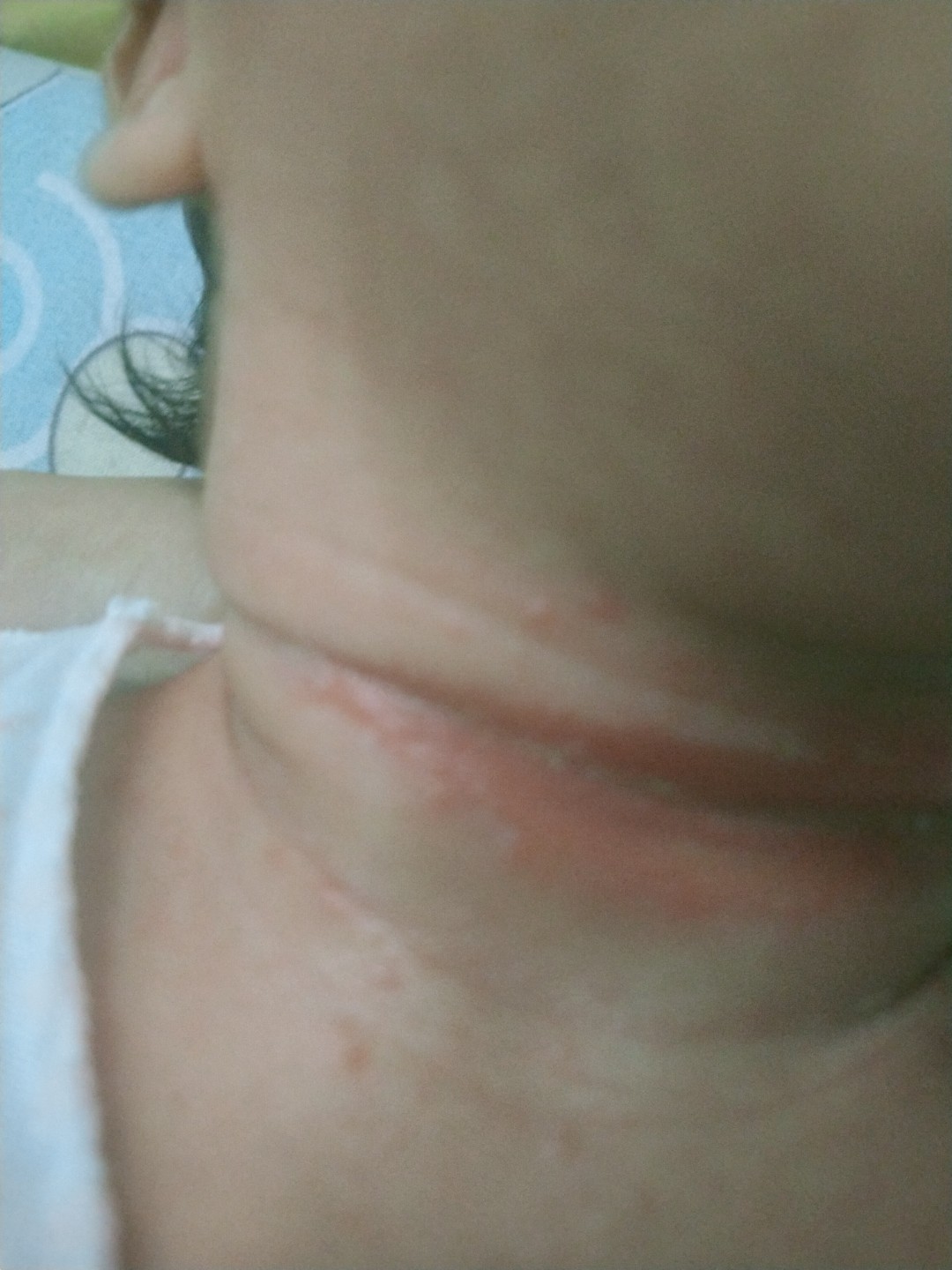bayi umur 12 hari