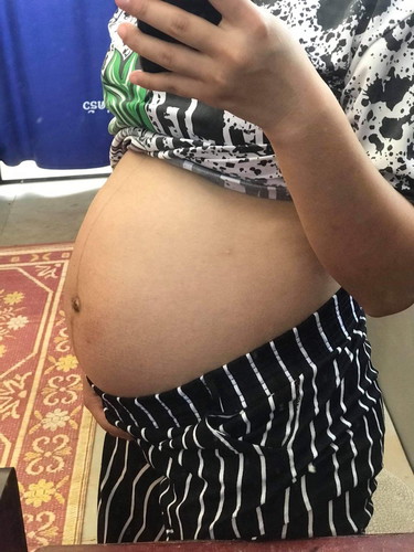 32W 5D