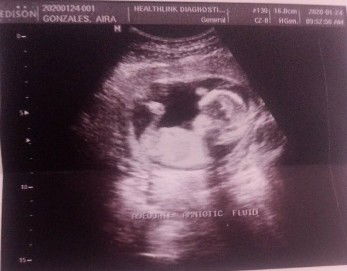 Aira Gonzales profile icon