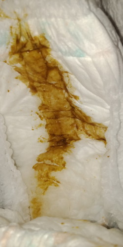 อึน้องแบบนี้ปกติไหมคะ