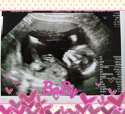 BaBy...ของพี่อุ๊บอิ๊บ