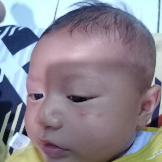 digigit nyamuk