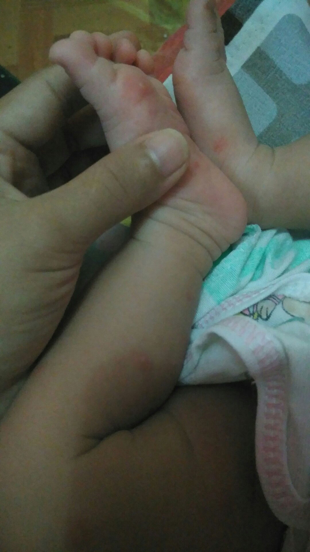 bintik-bintik merah Dan berair