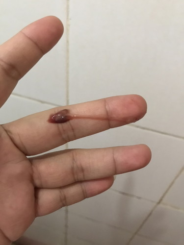 Normal lang po ba sa 26 weeks ito?