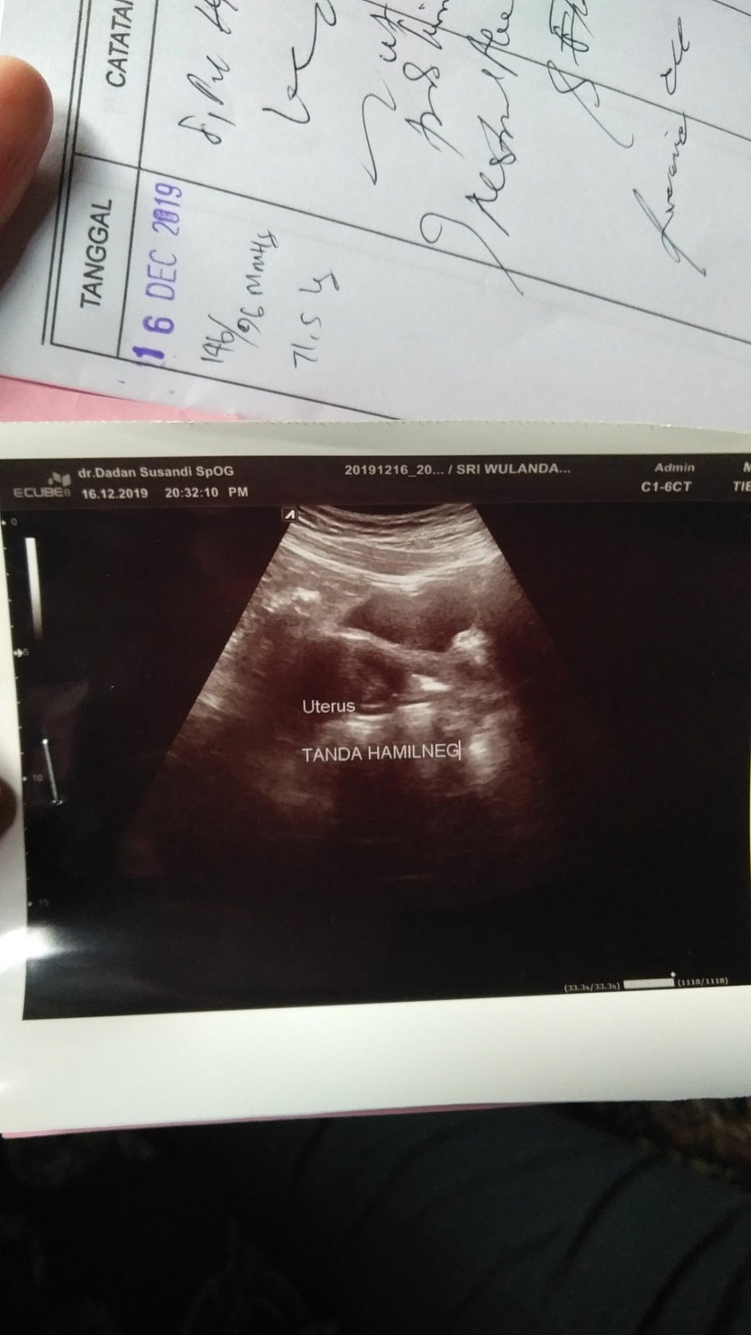 1 bulan telat mens tespack fositip tapi usg negatif ?