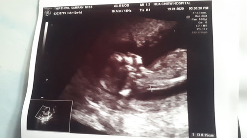 13สัปดาแล้วค่ะ