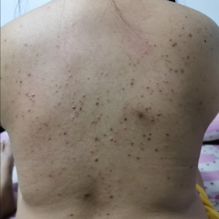 ฮอร์โมนคุณแม่