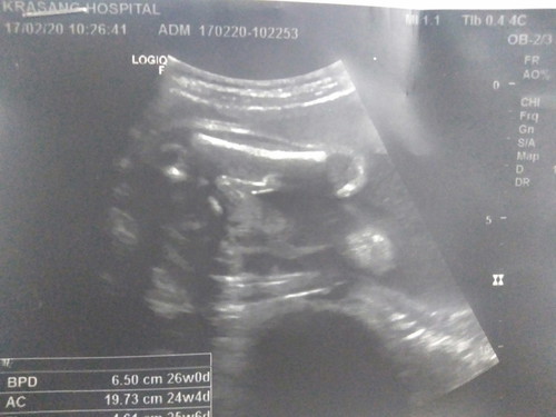 ช่วยดูเพศหน่อยค้า