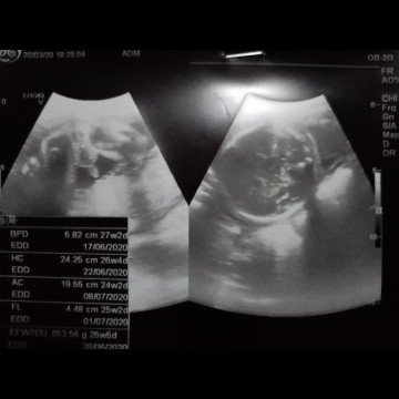 ตัวเล๊กของม๊ามี๊