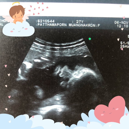 28weeks แล้วนะคะ?