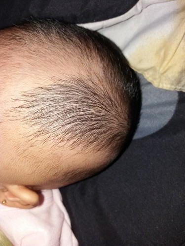 Pertumbuhan Rambut