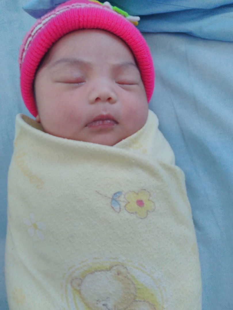 Lahir di induksi setelah bukaan 2 seminggu