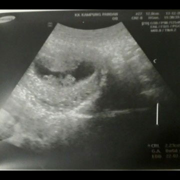 8 weeks or 10 weeks ??