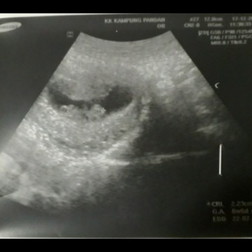 8 weeks or 10 weeks ??