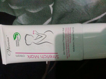 cream stretchmark