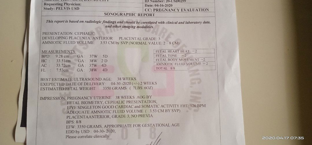 LMP or Ultrasound accuracy