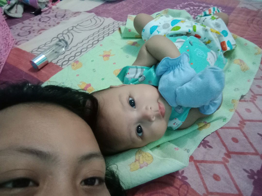 sunat bayi perempuan