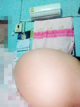 ลูกดิ้นทั้งวันแต่ท้องก็ปั้นแข็งจุกแน่นหายใจไม่สะดวก ใครมีอาการแบบนี้บ้างค่ะ แล้วจะเป็นอันตรายกับลูกไหมค่ะ