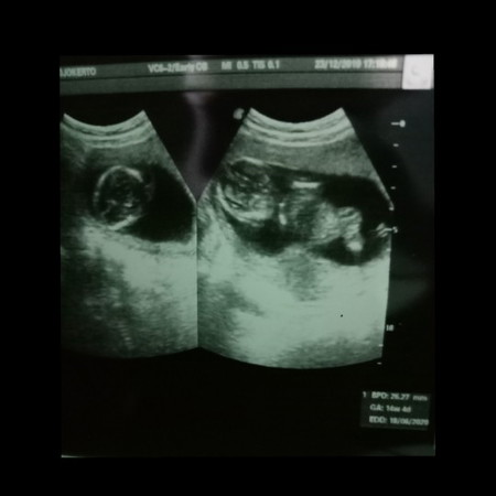 bersyukur alhamdulilah