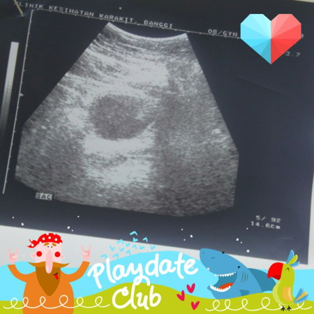 nak tanya...ada kantung x...sbb sy x tau ada ke x...first bby ni....