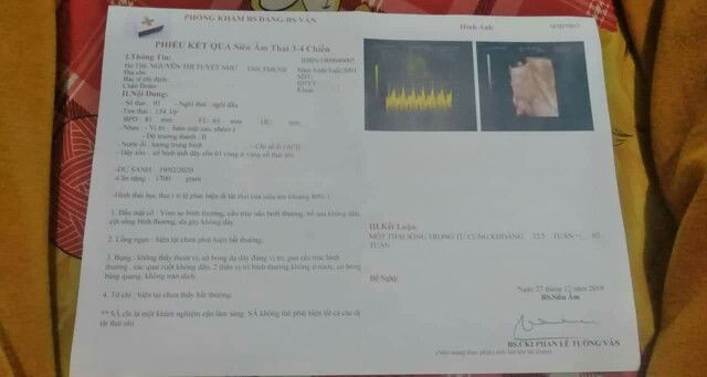 ngôi đầu là sao?