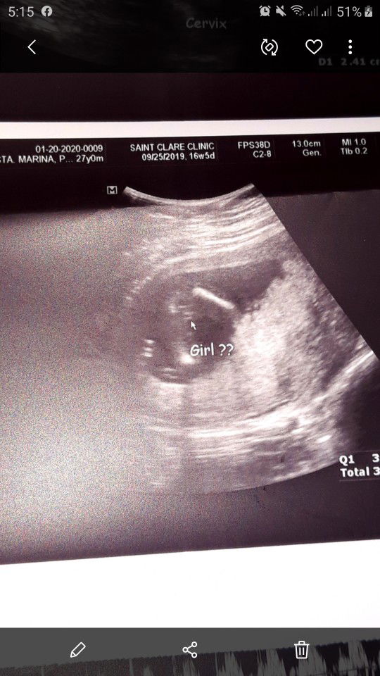 16weeks 4days Pelvic Ultrasound(BabyGirl??)
