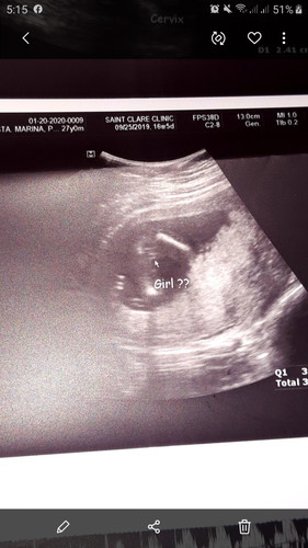 16weeks 4days Pelvic Ultrasound(BabyGirl??)