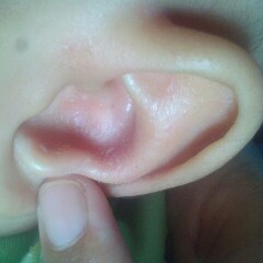 Kuping