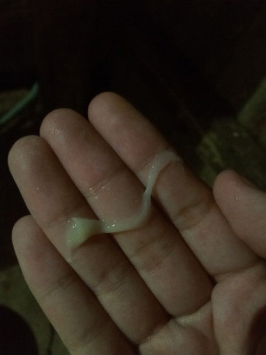 มูกใสหรือตกขาวค่ะ