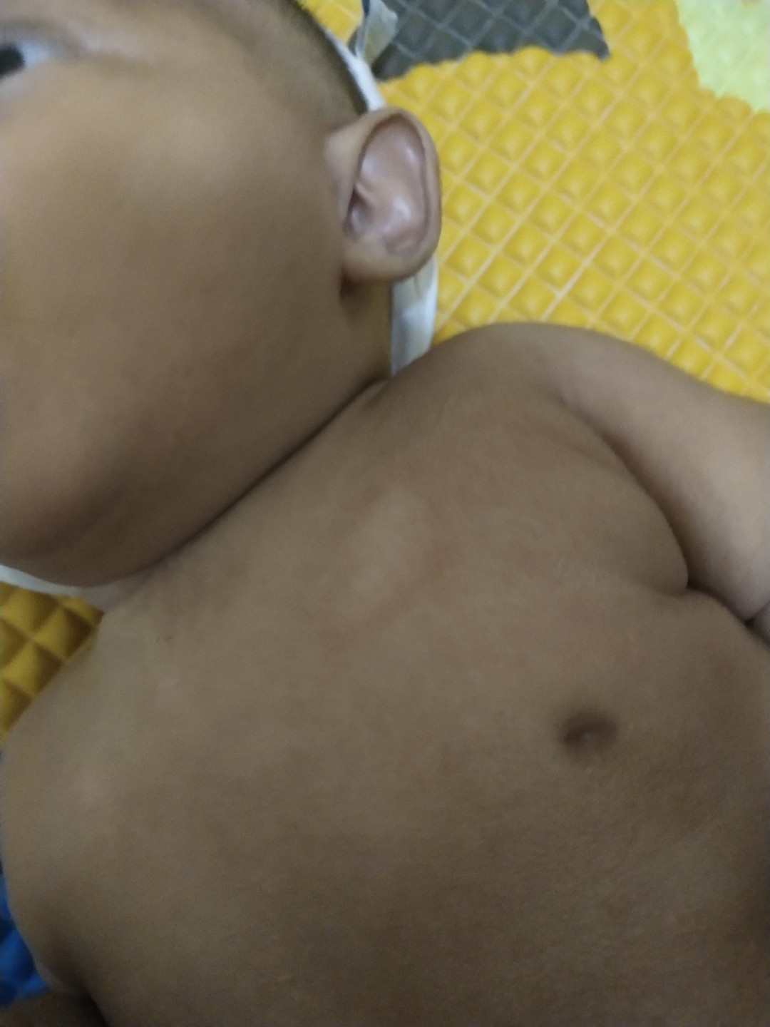 kulit tiba2 kok putih dan kasar ya