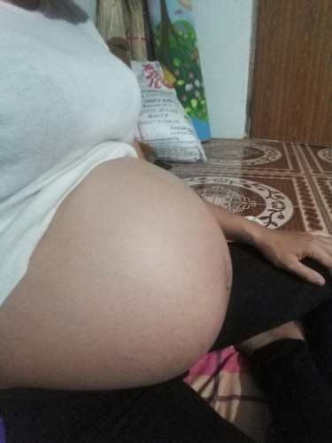 ท้องปั้นท้องแข็งบ่อย