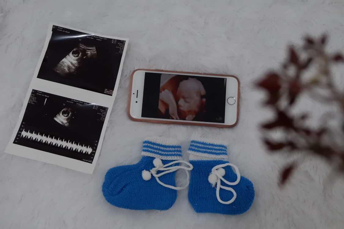 Nur Isna profile icon