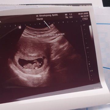 sedikit cerita ya bunda"