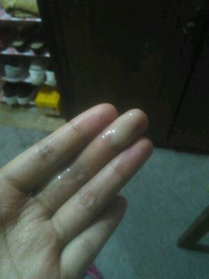 keputihan abnormal dari awal hamil sampe skrg 31wk