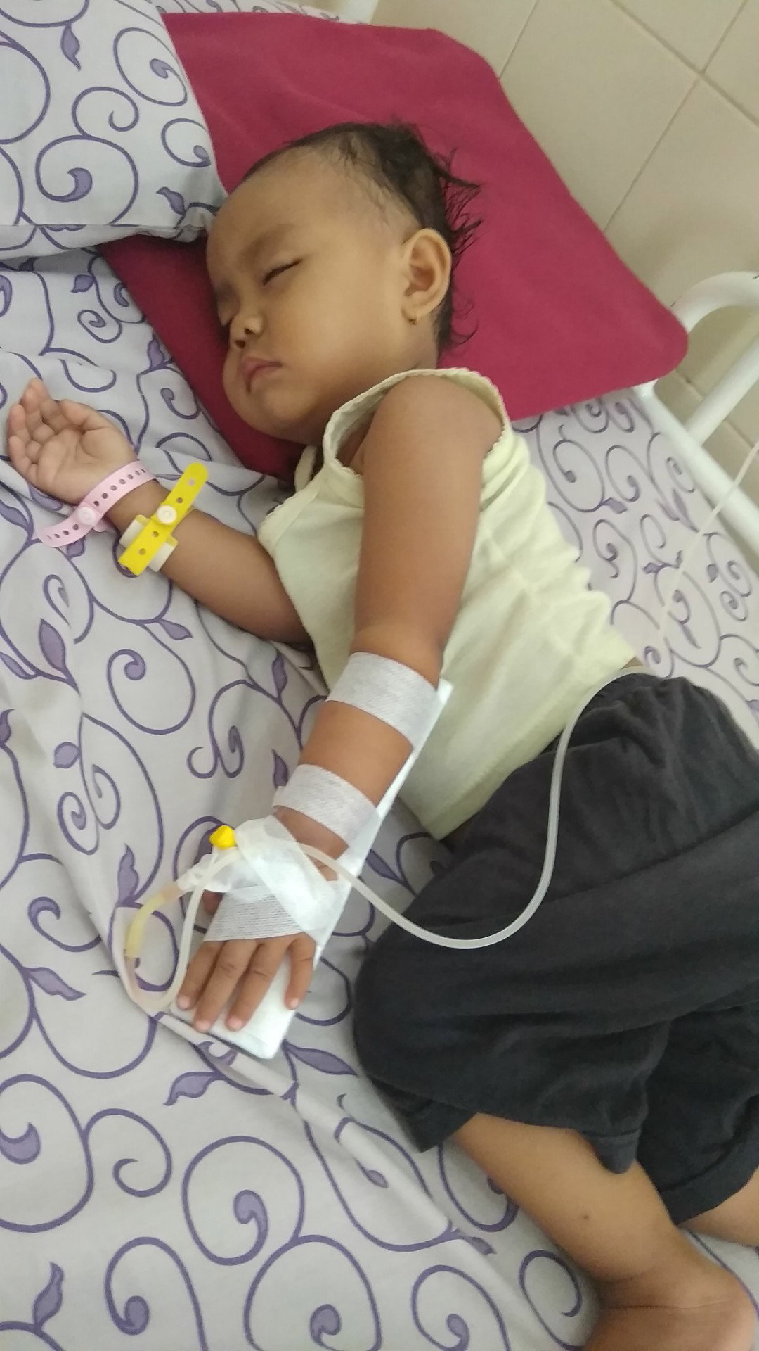Kejang pada anak