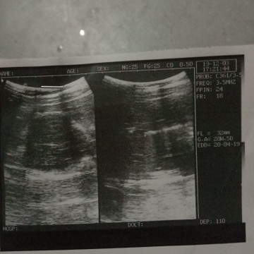อยากรู้เพศลูก