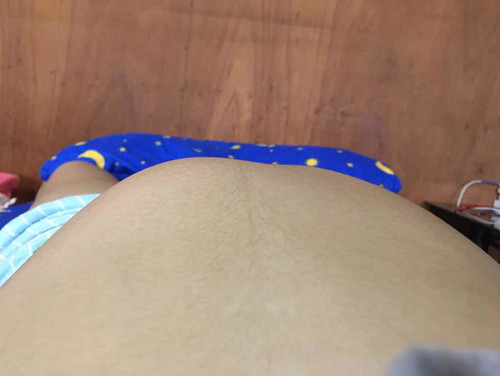 28W+2